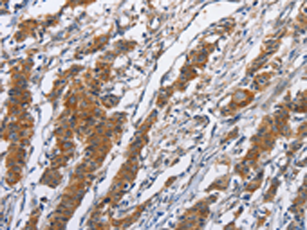 NCAPD3