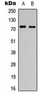 SLC6A16
