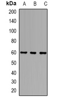 Alpha-1D Adrenergic Receptor