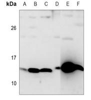 SAA重组单抗定制公司