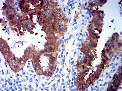 CDKN2A抗体开发免疫组化